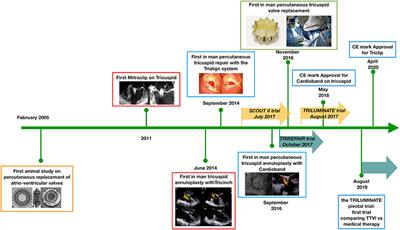 Future Perspectives in Percutaneous Treatment of Tricuspid Regurgitation